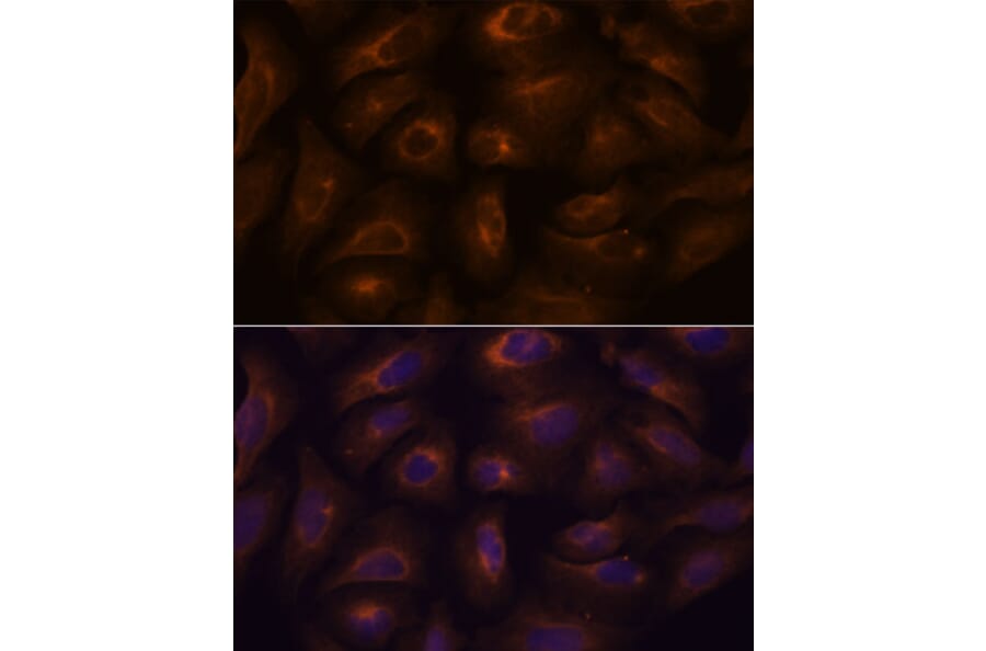 Immunofluorescence - Anti-GPCR GPR22 Antibody (A307102) - Antibodies.com