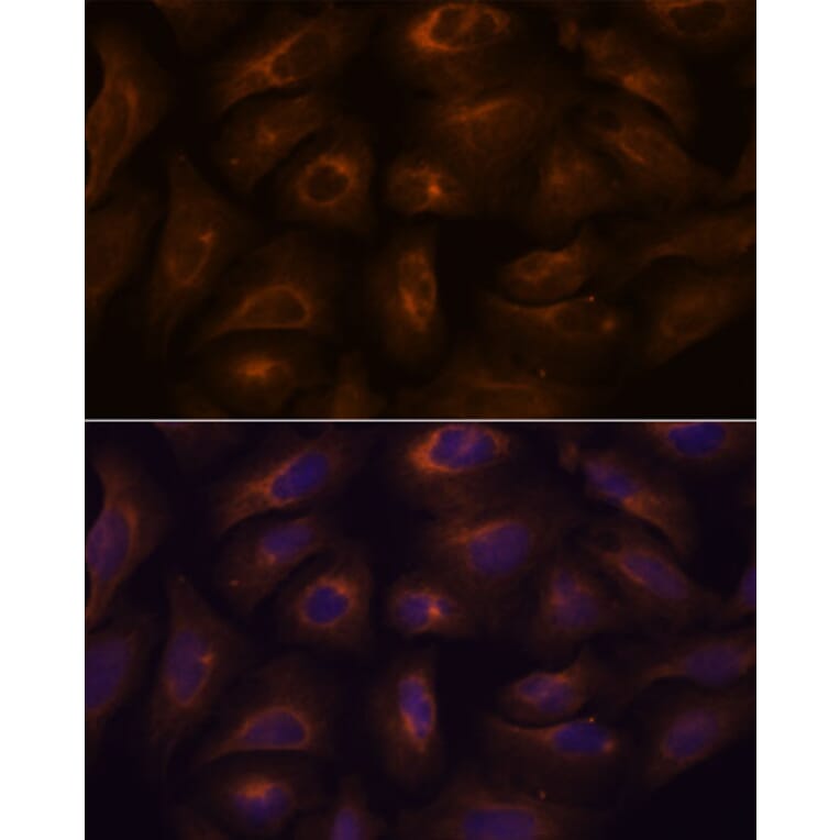 Immunofluorescence - Anti-GPCR GPR22 Antibody (A307102) - Antibodies.com
