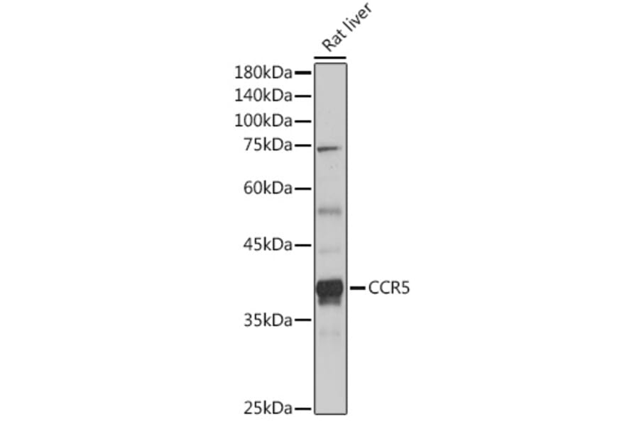 Western Blot - Anti-CCR5 Antibody (A307104) - Antibodies.com