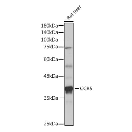 Western Blot - Anti-CCR5 Antibody (A307104) - Antibodies.com