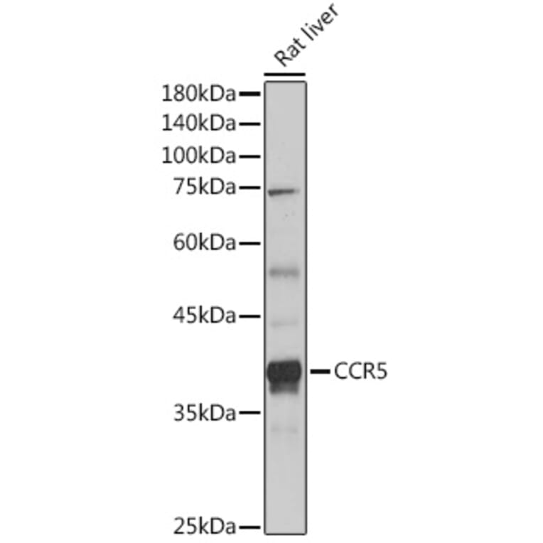Western Blot - Anti-CCR5 Antibody (A307104) - Antibodies.com