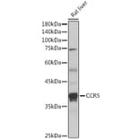 Western Blot - Anti-CCR5 Antibody (A307104) - Antibodies.com
