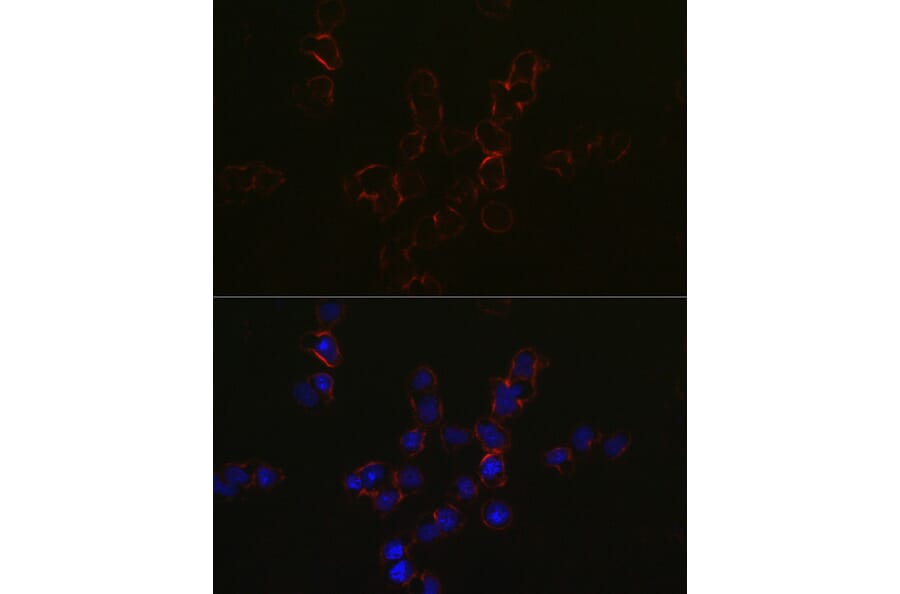 Immunofluorescence - Anti-CCR5 Antibody (A307104) - Antibodies.com