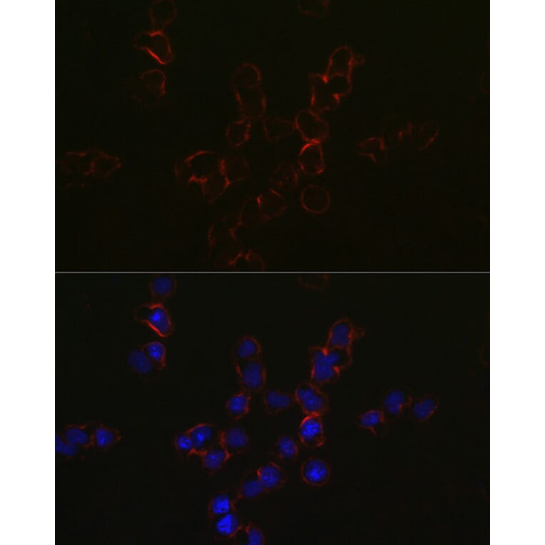 Immunofluorescence - Anti-CCR5 Antibody (A307104) - Antibodies.com