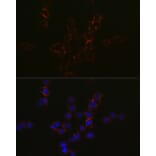 Immunofluorescence - Anti-CCR5 Antibody (A307104) - Antibodies.com
