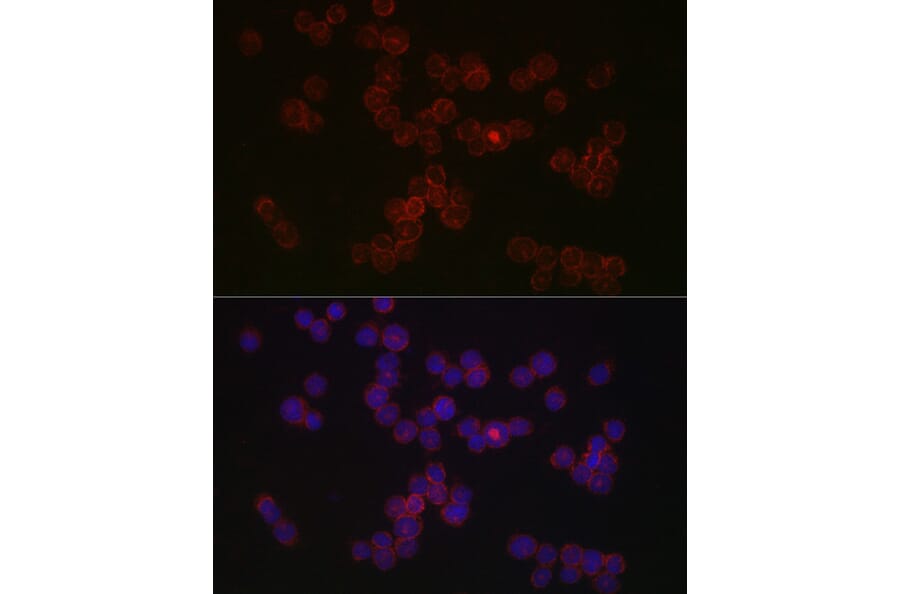 Immunofluorescence - Anti-CCR5 Antibody (A307104) - Antibodies.com