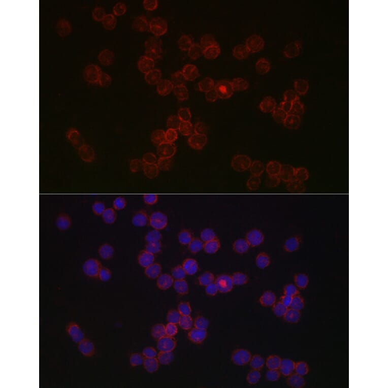 Immunofluorescence - Anti-CCR5 Antibody (A307104) - Antibodies.com