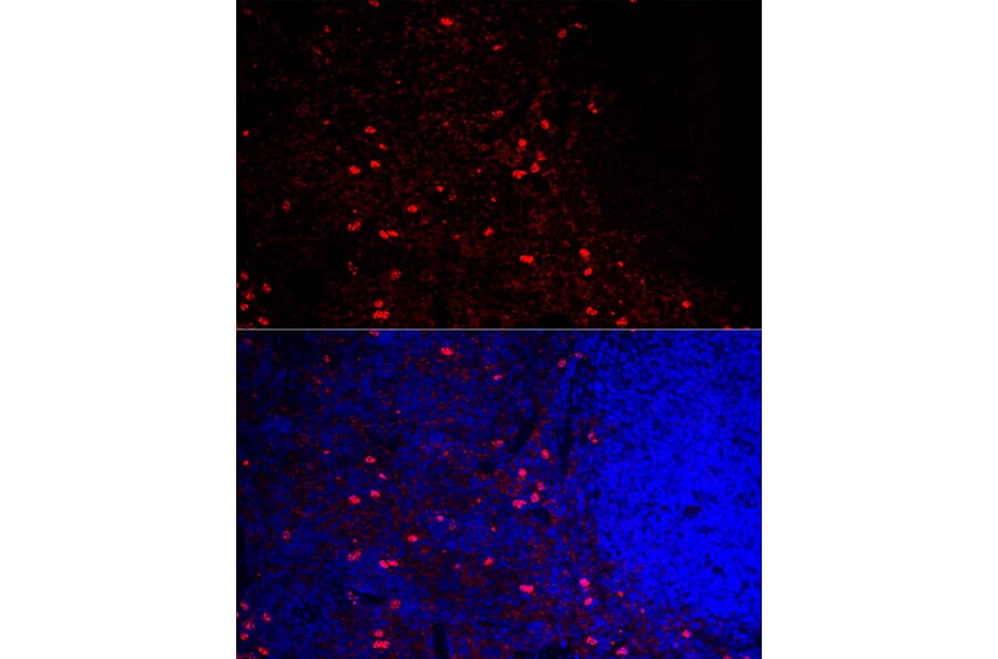 Immunofluorescence - Anti-CCR5 Antibody (A307104) - Antibodies.com