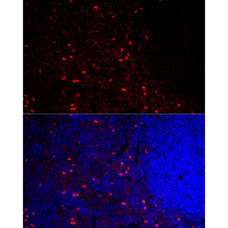 Immunofluorescence - Anti-CCR5 Antibody (A307104) - Antibodies.com