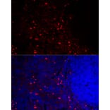 Immunofluorescence - Anti-CCR5 Antibody (A307104) - Antibodies.com
