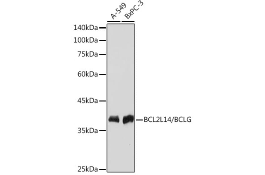 Western Blot - Anti-Bcl G/BCL2L14 Antibody [ARC2474] (A307106) - Antibodies.com