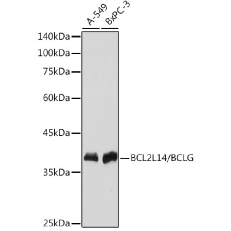 Western Blot - Anti-Bcl G/BCL2L14 Antibody [ARC2474] (A307106) - Antibodies.com