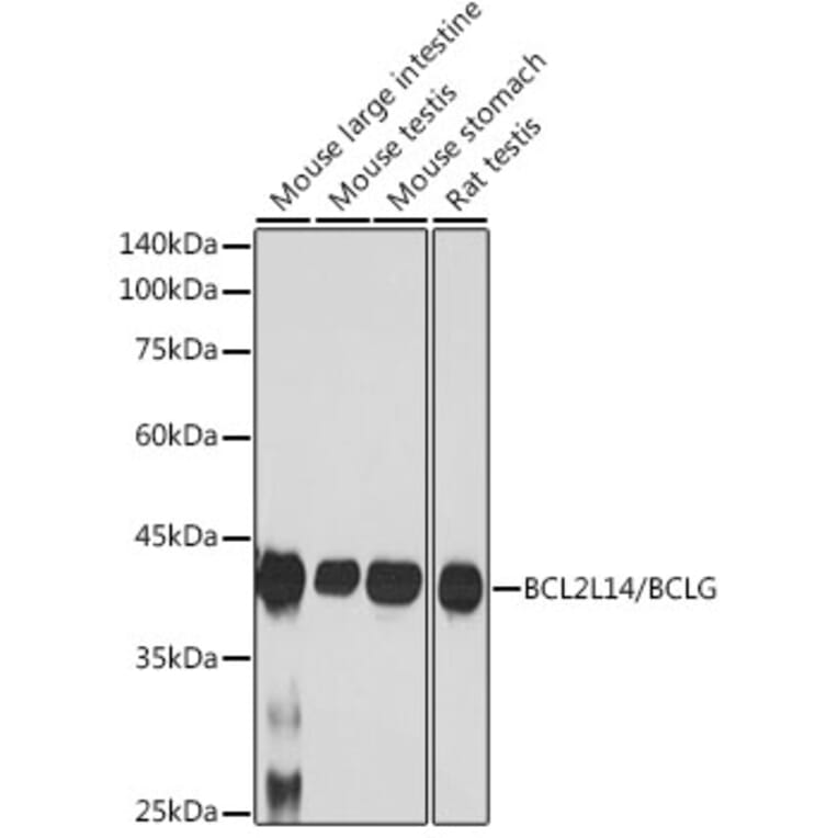 Western Blot - Anti-Bcl G/BCL2L14 Antibody [ARC2474] (A307106) - Antibodies.com