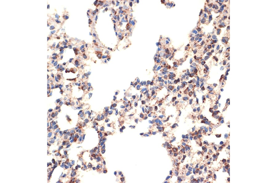 Immunohistochemistry - Anti-Bcl G/BCL2L14 Antibody [ARC2474] (A307106) - Antibodies.com