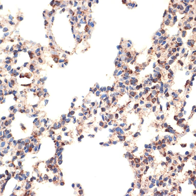 Immunohistochemistry - Anti-Bcl G/BCL2L14 Antibody [ARC2474] (A307106) - Antibodies.com