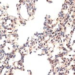 Immunohistochemistry - Anti-Bcl G/BCL2L14 Antibody [ARC2474] (A307106) - Antibodies.com