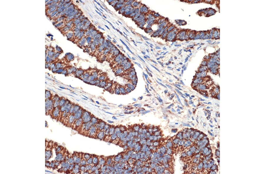 Immunohistochemistry - Anti-Bcl G/BCL2L14 Antibody [ARC2474] (A307106) - Antibodies.com