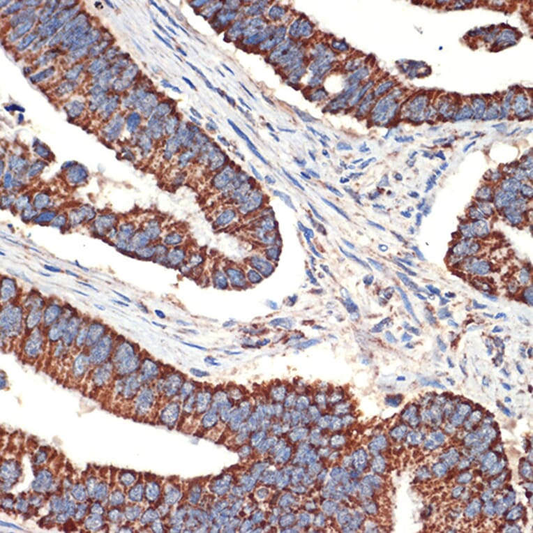 Immunohistochemistry - Anti-Bcl G/BCL2L14 Antibody [ARC2474] (A307106) - Antibodies.com