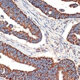 Immunohistochemistry - Anti-Bcl G/BCL2L14 Antibody [ARC2474] (A307106) - Antibodies.com