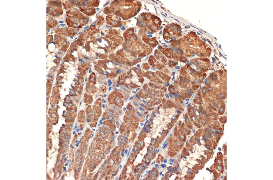 Immunohistochemistry - Anti-Bcl G/BCL2L14 Antibody [ARC2474] (A307106) - Antibodies.com
