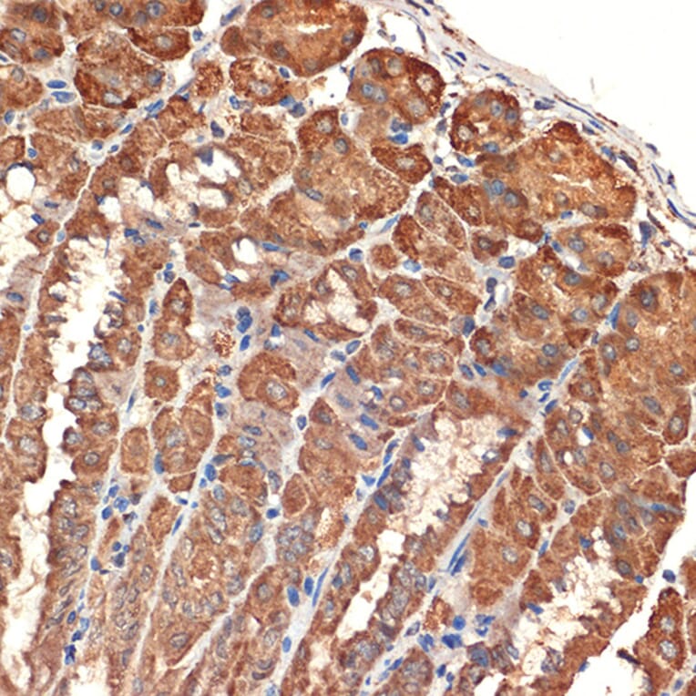 Immunohistochemistry - Anti-Bcl G/BCL2L14 Antibody [ARC2474] (A307106) - Antibodies.com
