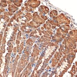 Immunohistochemistry - Anti-Bcl G/BCL2L14 Antibody [ARC2474] (A307106) - Antibodies.com