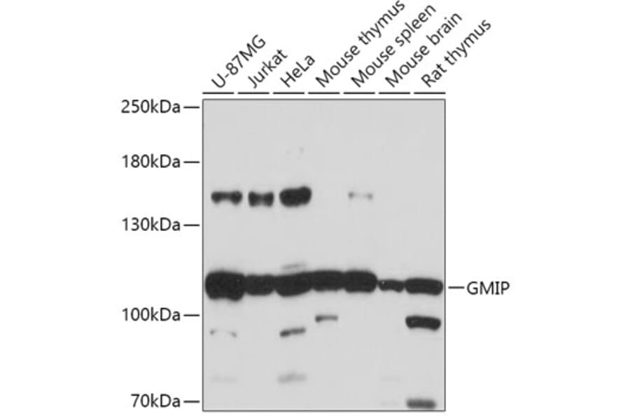 Western Blot - Anti-GMIP Antibody (A307109) - Antibodies.com