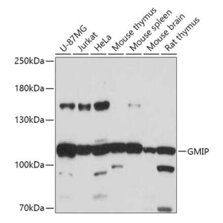 Western Blot - Anti-GMIP Antibody (A307109) - Antibodies.com