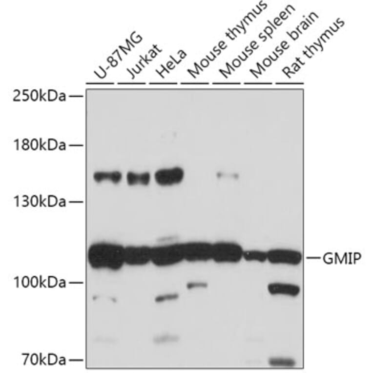 Western Blot - Anti-GMIP Antibody (A307109) - Antibodies.com
