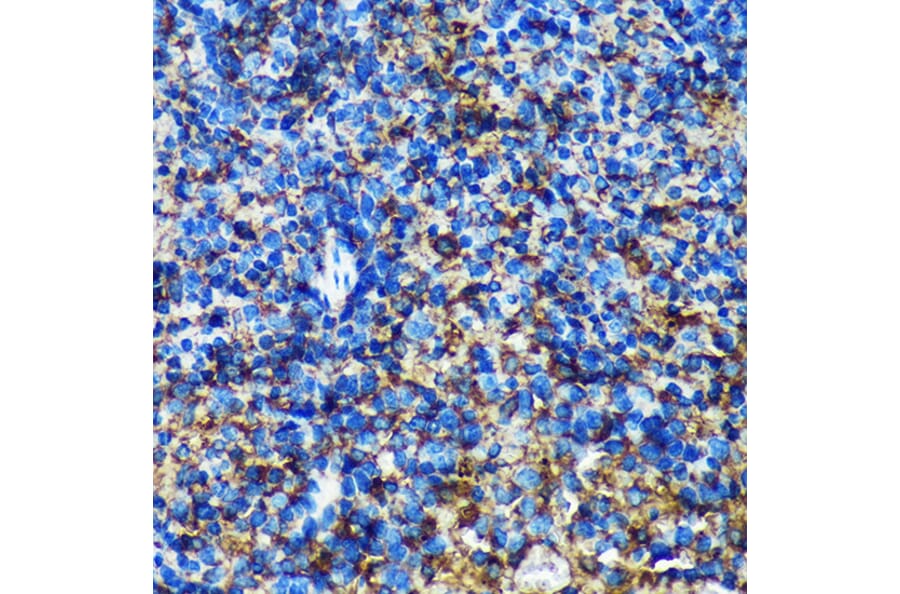 Immunohistochemistry - Anti-GMIP Antibody (A307109) - Antibodies.com