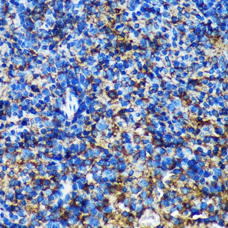 Immunohistochemistry - Anti-GMIP Antibody (A307109) - Antibodies.com