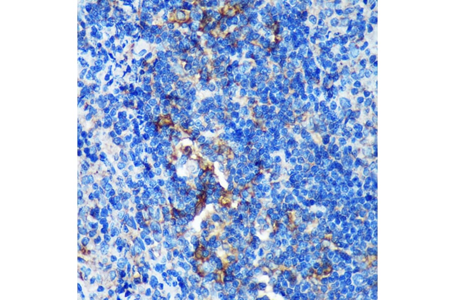 Immunohistochemistry - Anti-GMIP Antibody (A307109) - Antibodies.com