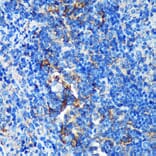 Immunohistochemistry - Anti-GMIP Antibody (A307109) - Antibodies.com
