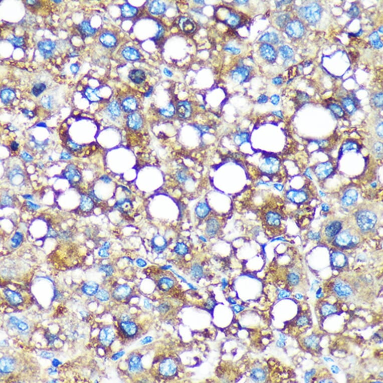 Immunohistochemistry - Anti-GMIP Antibody (A307109) - Antibodies.com