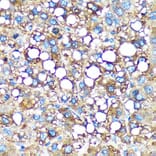 Immunohistochemistry - Anti-GMIP Antibody (A307109) - Antibodies.com