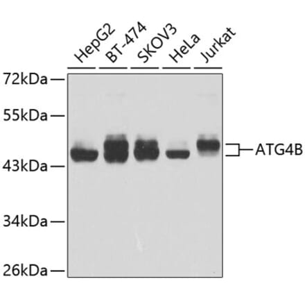 Western Blot - Anti-ATG4B Antibody (A307110) - Antibodies.com