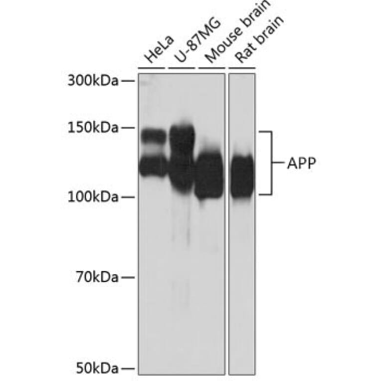 Western Blot - Anti-Amyloid Precursor Protein Antibody [ARC0465] (A307112) - Antibodies.com