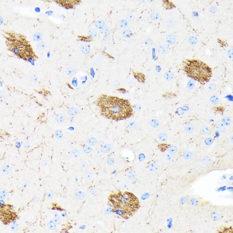 Immunohistochemistry - Anti-Amyloid Precursor Protein Antibody [ARC0465] (A307112) - Antibodies.com