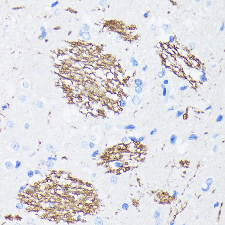 Immunohistochemistry - Anti-Amyloid Precursor Protein Antibody [ARC0465] (A307112) - Antibodies.com