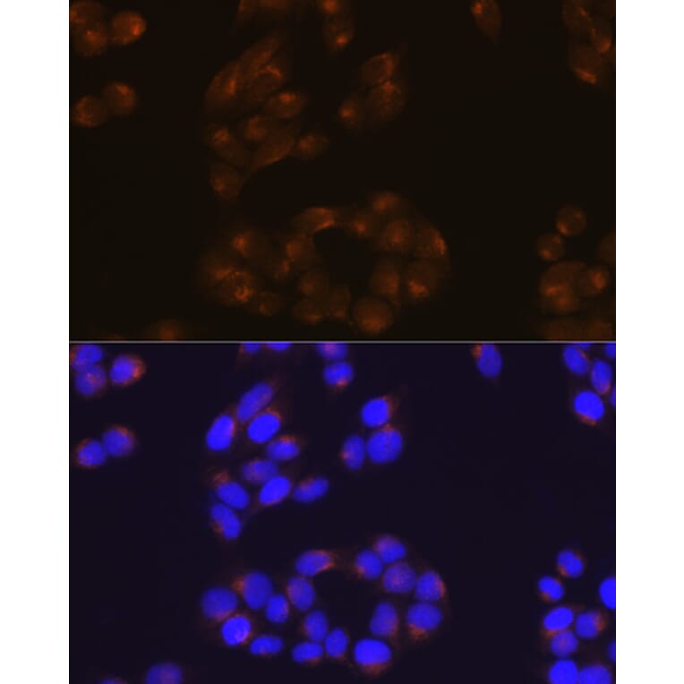 Immunofluorescence - Anti-Amyloid Precursor Protein Antibody [ARC0465] (A307112) - Antibodies.com