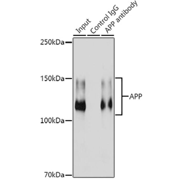 Western Blot - Anti-Amyloid Precursor Protein Antibody [ARC0465] (A307112) - Antibodies.com