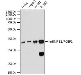Western Blot - Anti-PCBP1 Antibody [ARC2456] (A307113) - Antibodies.com