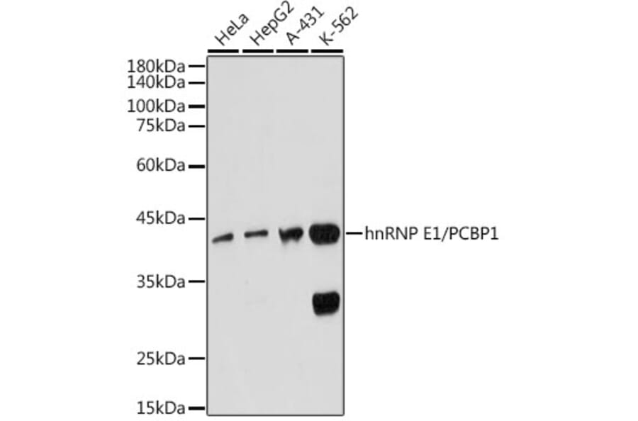 Western Blot - Anti-PCBP1 Antibody [ARC2456] (A307113) - Antibodies.com