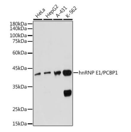 Western Blot - Anti-PCBP1 Antibody [ARC2456] (A307113) - Antibodies.com