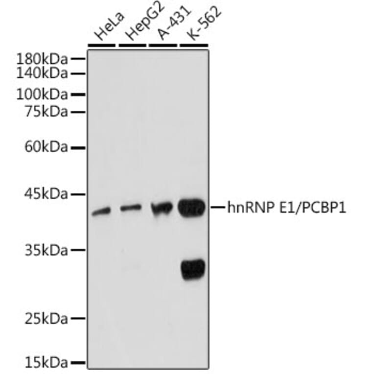 Western Blot - Anti-PCBP1 Antibody [ARC2456] (A307113) - Antibodies.com