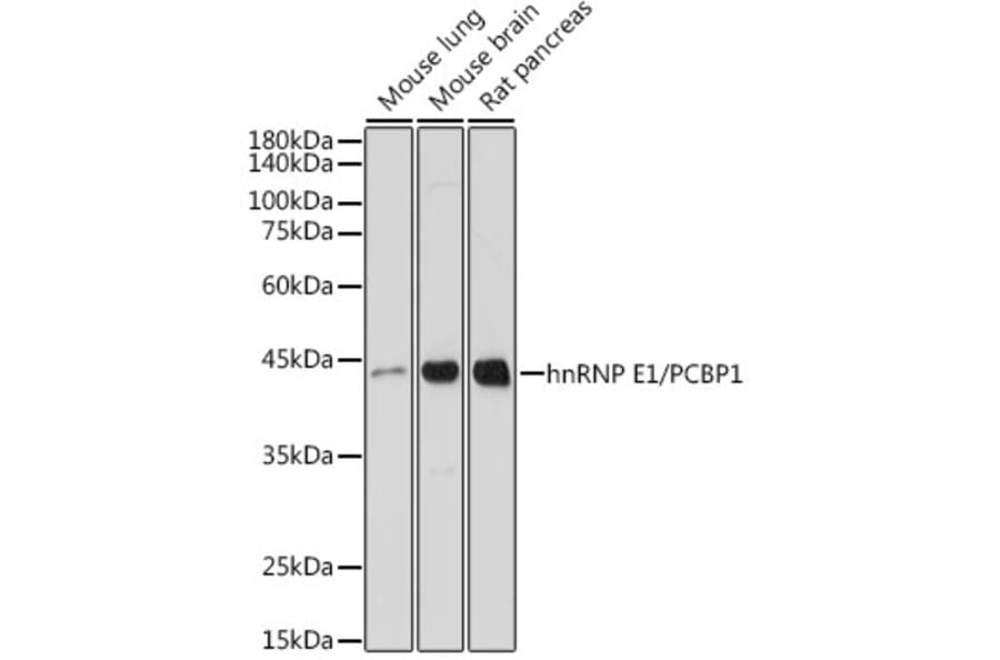 Western Blot - Anti-PCBP1 Antibody [ARC2456] (A307113) - Antibodies.com