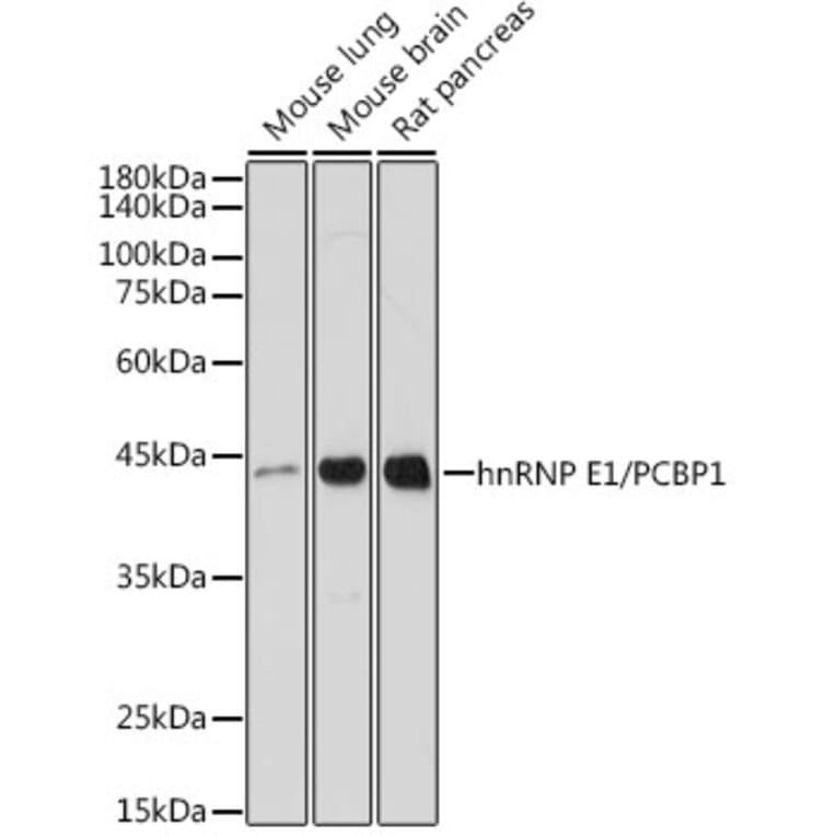 Western Blot - Anti-PCBP1 Antibody [ARC2456] (A307113) - Antibodies.com