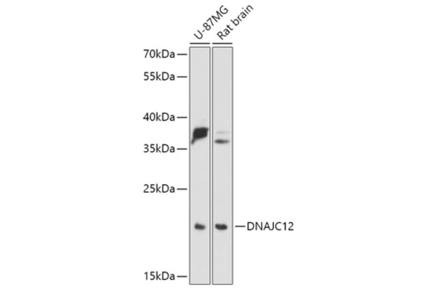Western Blot - Anti-DNAJC12 Antibody (A307114) - Antibodies.com