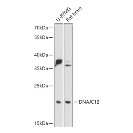 Western Blot - Anti-DNAJC12 Antibody (A307114) - Antibodies.com
