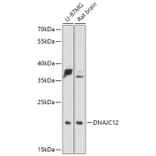 Western Blot - Anti-DNAJC12 Antibody (A307114) - Antibodies.com